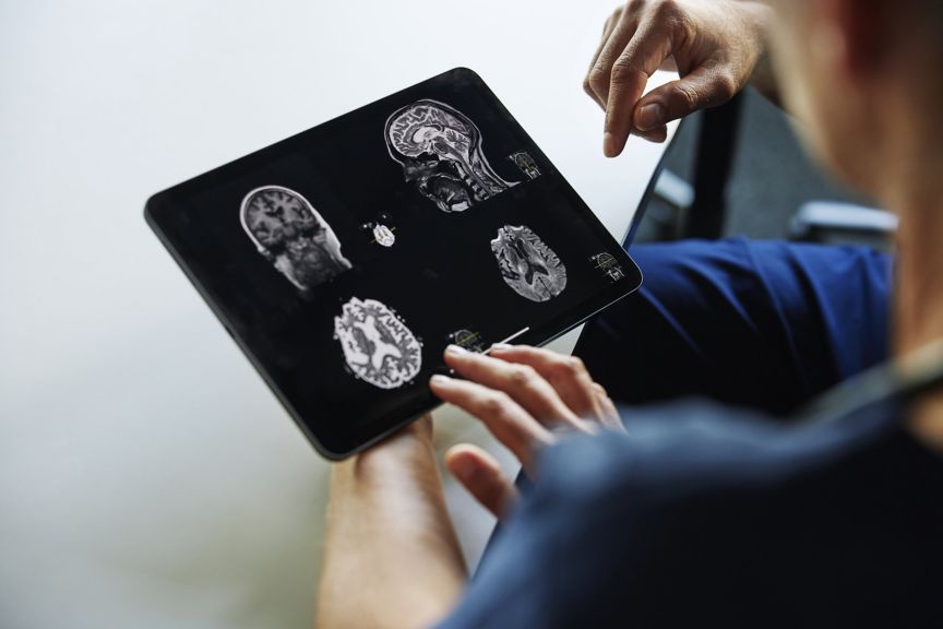 A healthcare professional uses a tablet computer to review multiple MRI images of a human brain in a clinical environment.
