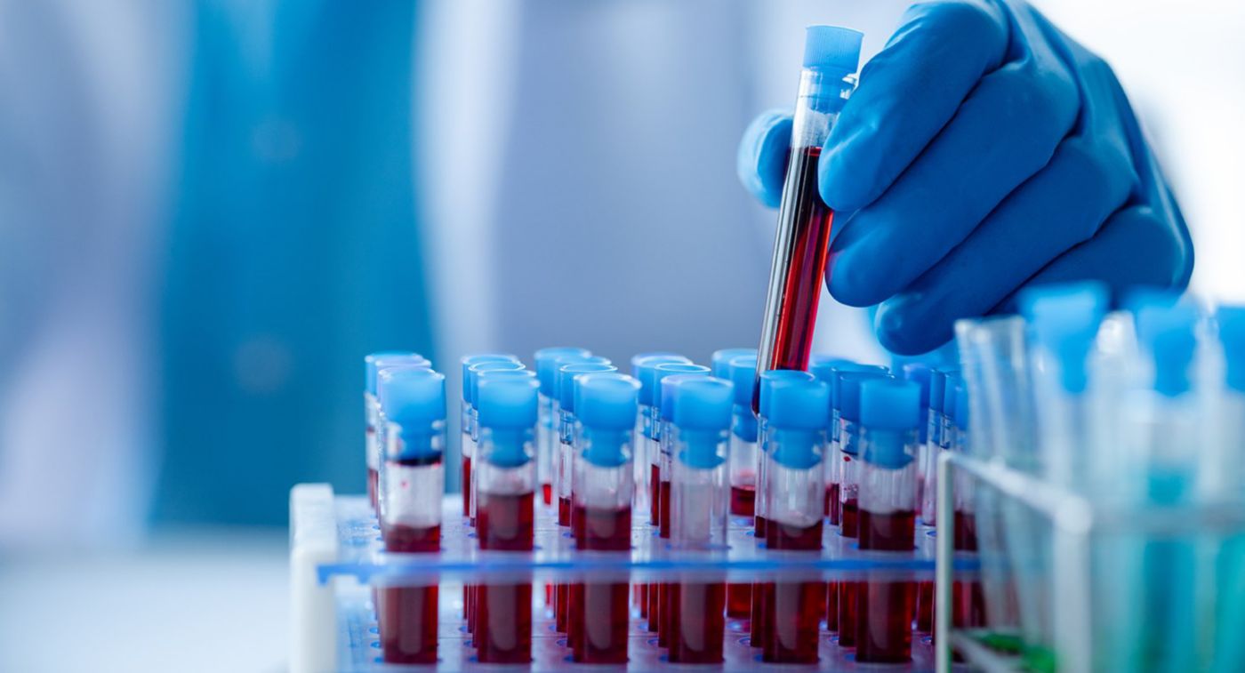A blue-gloved laboratory worker places a blood sample tube into a rack of labeled test tubes.