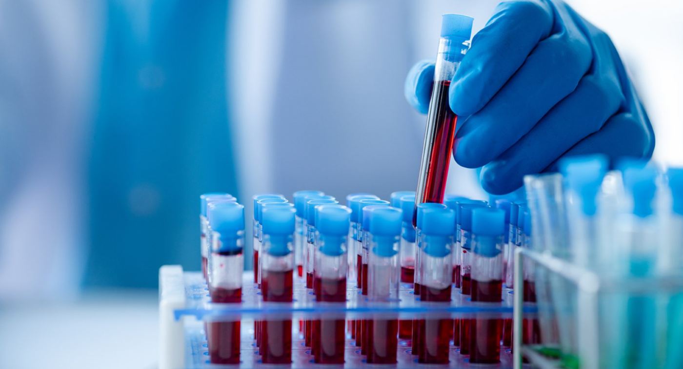 A blue-gloved laboratory worker places a blood sample tube into a rack of labeled test tubes.