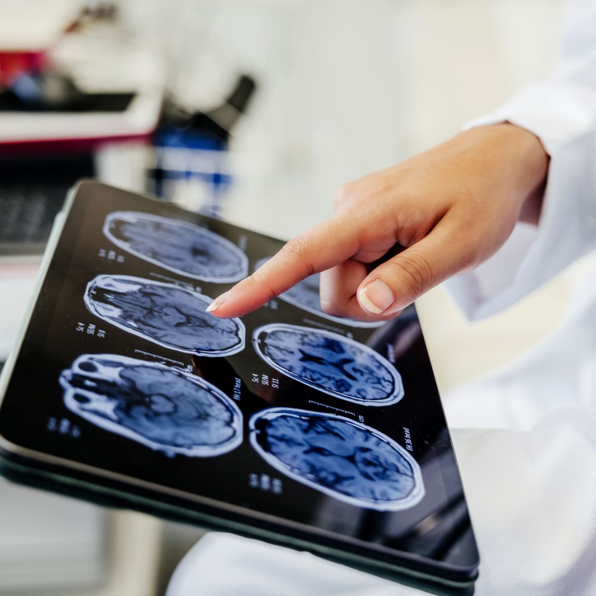 hon-doctor-reviewing-brain-mri-scans-digital-tablet-2148728482.jpg