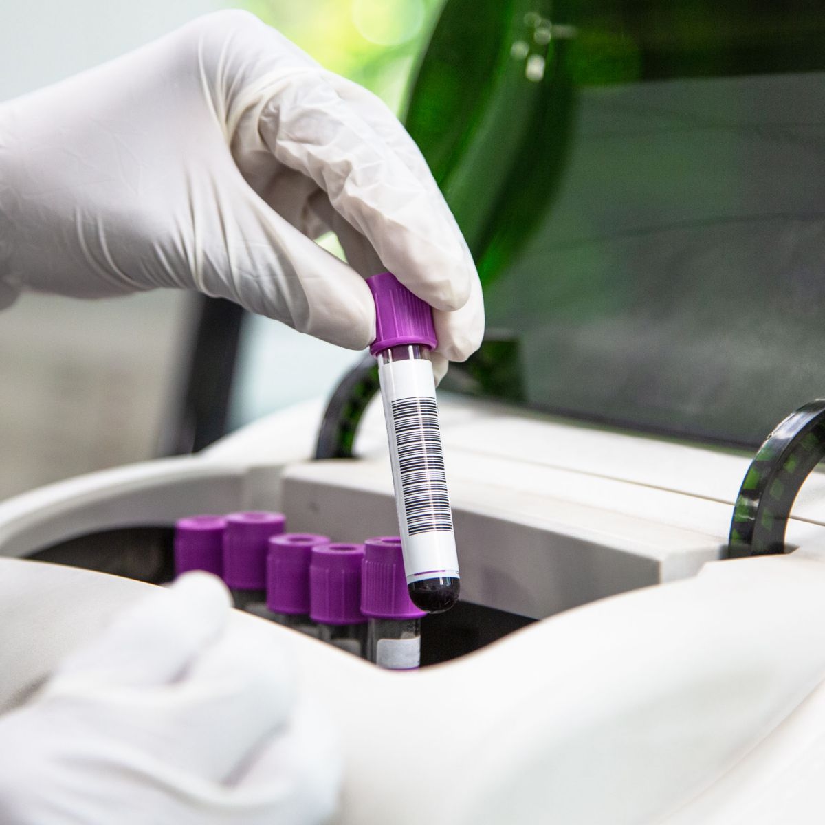 hon-lab-technician-loading-blood-sample-analyzer-1193974989.jpg