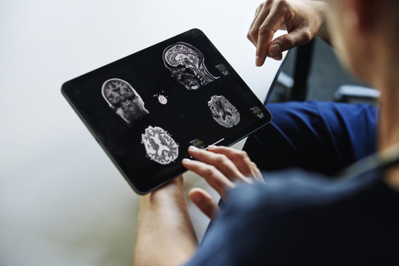 A healthcare professional uses a tablet computer to review multiple MRI images of a human brain in a clinical environment.
